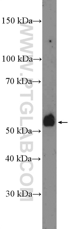 Western Blot (WB) analysis of SW 1990 cells using TMPRSS4 Polyclonal antibody (11283-1-AP)