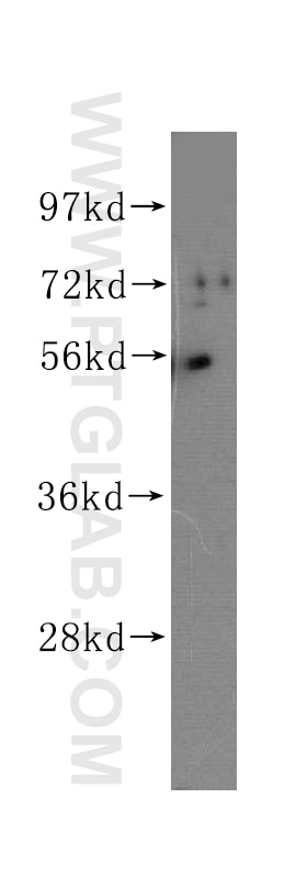 Western Blot (WB) analysis of BxPC-3 cells using TMPRSS4 Polyclonal antibody (11283-1-AP)