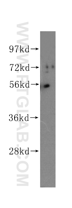 WB analysis of BxPC-3 using 11283-1-AP