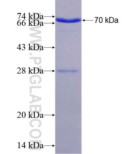 TMPRSS4 fusion protein Ag1804 SDS-PAGE