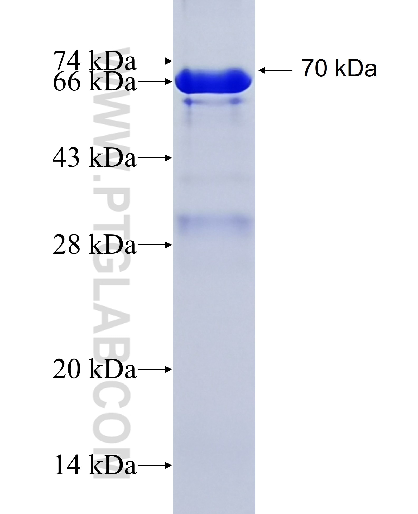 TMPRSS4 fusion protein Ag1804 SDS-PAGE