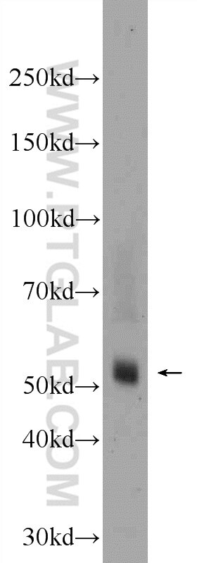 Western Blot (WB) analysis of rat brain tissue using TMPRSS5 Polyclonal antibody (24616-1-AP)