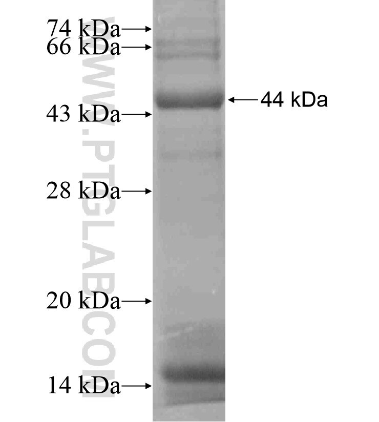 TMPRSS5 fusion protein Ag18427 SDS-PAGE