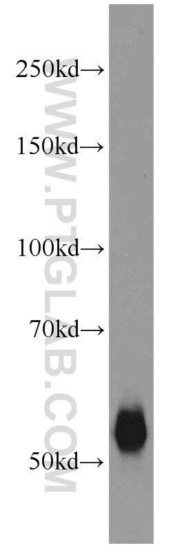 Western Blot (WB) analysis of MCF-7 cells using TMPRSS6 Polyclonal antibody (12950-1-AP)