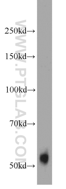 Western Blot (WB) analysis of mouse liver tissue using TMPRSS6 Polyclonal antibody (12950-1-AP)