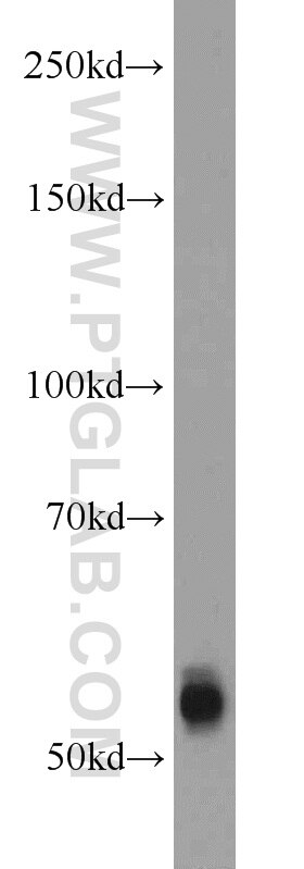 Western Blot (WB) analysis of HEK-293 cells using TMPRSS6 Polyclonal antibody (12950-1-AP)