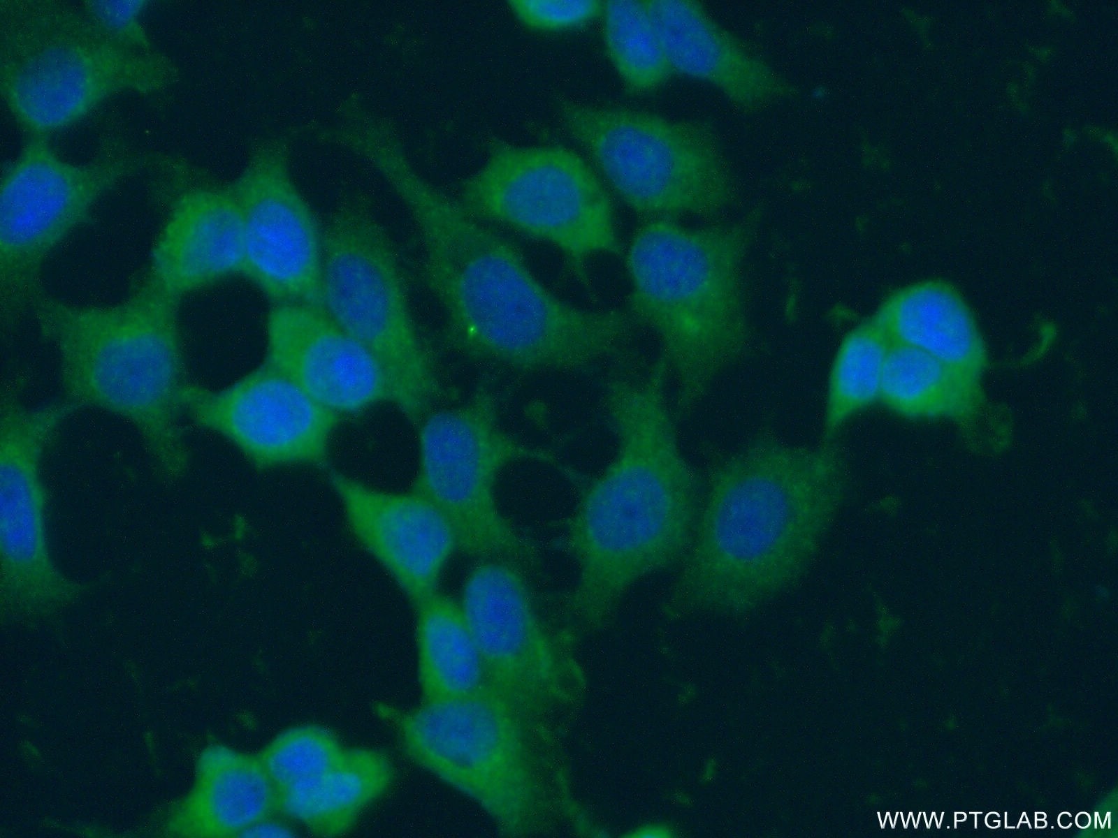 Immunofluorescence (IF) / fluorescent staining of MCF-7 cells using ASC/TMS1 Polyclonal antibody (10500-1-AP)