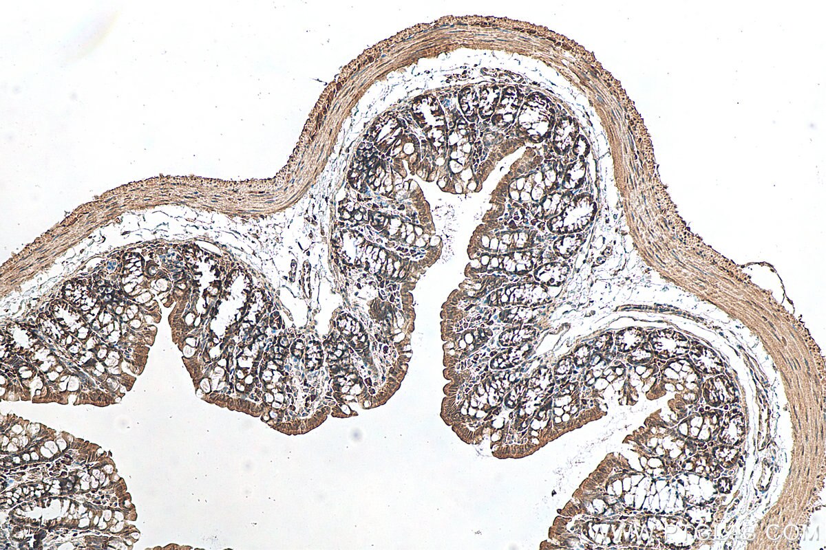 Immunohistochemistry (IHC) staining of mouse colon tissue using ASC/TMS1 Polyclonal antibody (10500-1-AP)