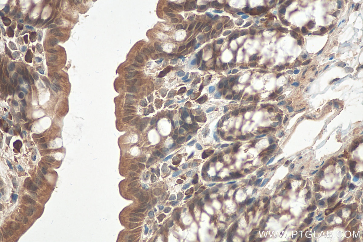 Immunohistochemistry (IHC) staining of mouse colon tissue using ASC/TMS1 Polyclonal antibody (10500-1-AP)