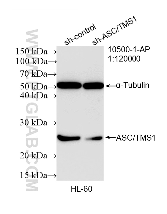 Western Blot (WB) analysis of HL-60 cells using ASC/TMS1 Polyclonal antibody (10500-1-AP)