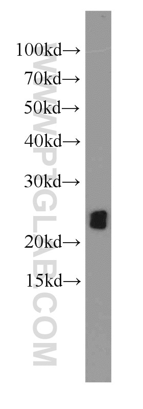 Western Blot (WB) analysis of A549 cells using ASC/TMS1 Polyclonal antibody (10500-1-AP)