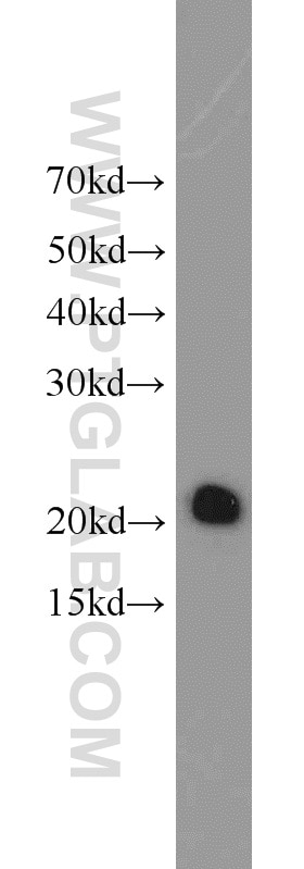 Western Blot (WB) analysis of Raji cells using ASC/TMS1 Polyclonal antibody (10500-1-AP)