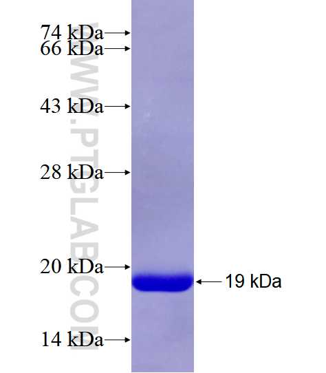 TMS1 fusion protein Ag28424 SDS-PAGE