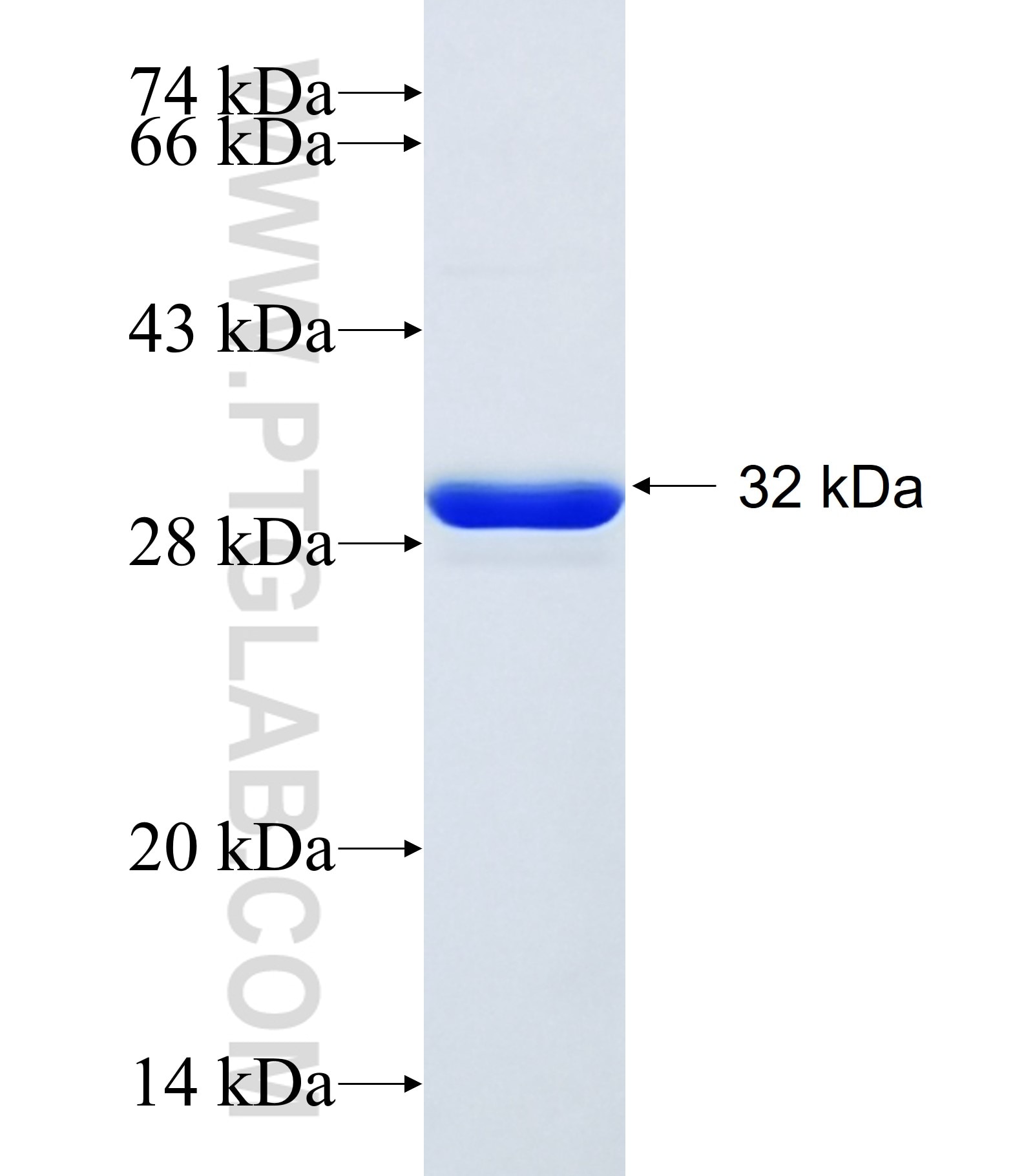 TMSB10 fusion protein Ag34308 SDS-PAGE