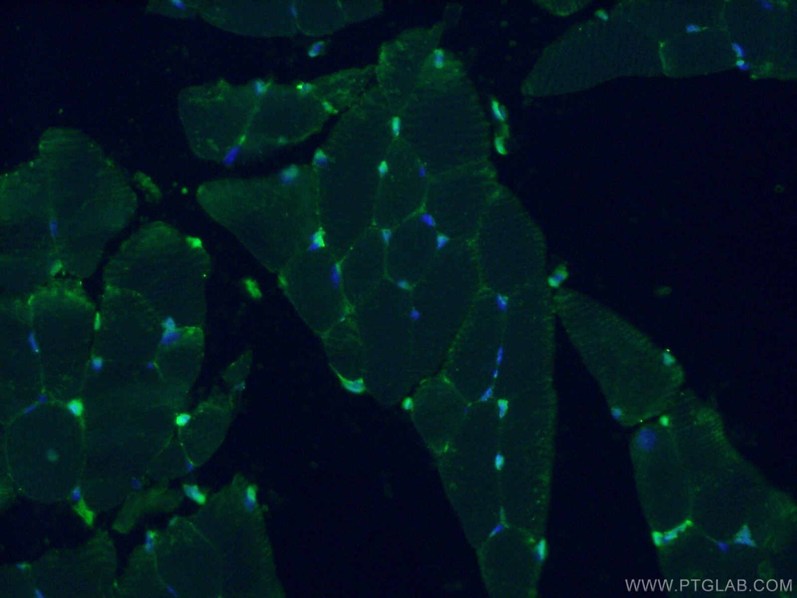 Thymosin beta 4