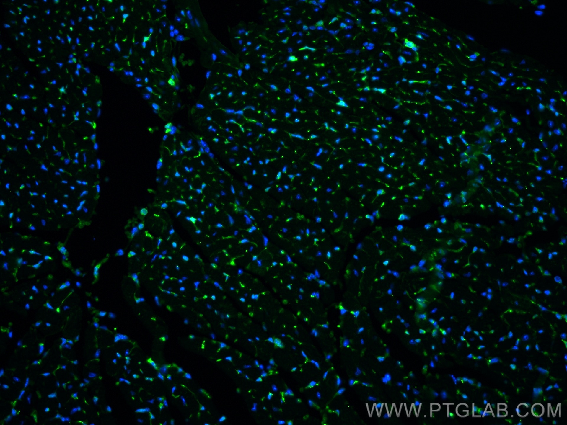 Immunofluorescence (IF) / fluorescent staining of mouse heart tissue using Thymosin beta 4 Polyclonal antibody (19850-1-AP)