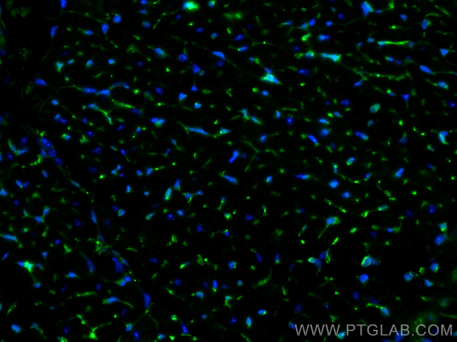 Immunofluorescence (IF) / fluorescent staining of mouse heart tissue using Thymosin beta 4 Polyclonal antibody (19850-1-AP)