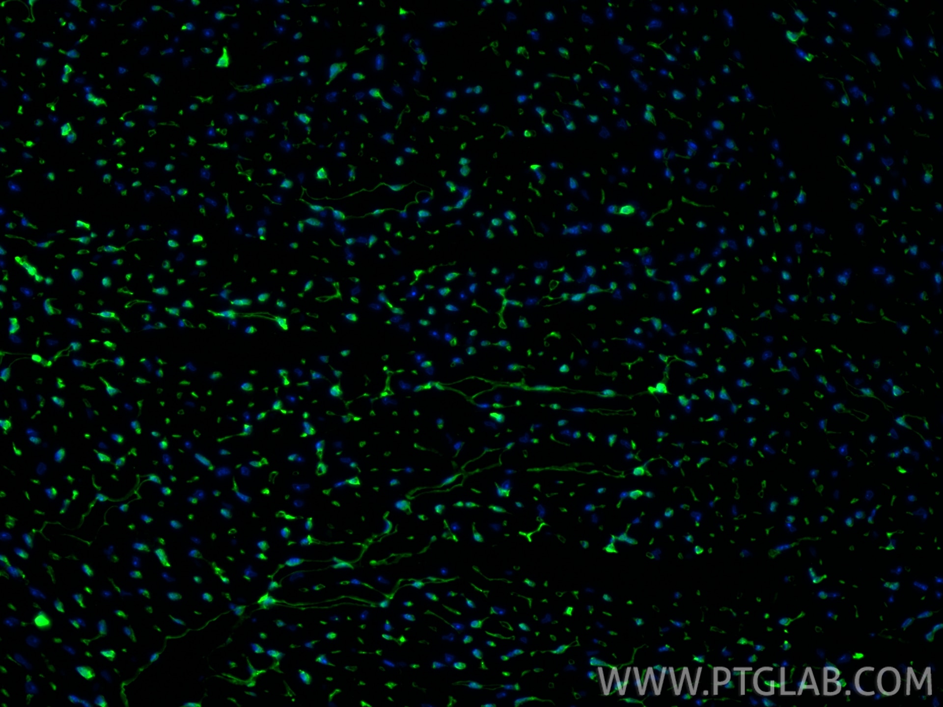 Immunofluorescence (IF) / fluorescent staining of mouse heart tissue using Thymosin beta 4 Polyclonal antibody (19850-1-AP)