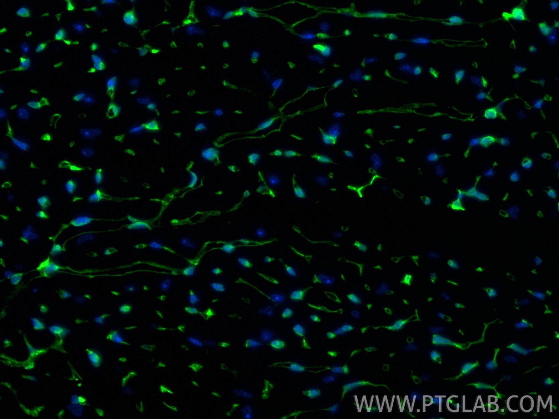 Immunofluorescence (IF) / fluorescent staining of mouse heart tissue using Thymosin beta 4 Polyclonal antibody (19850-1-AP)