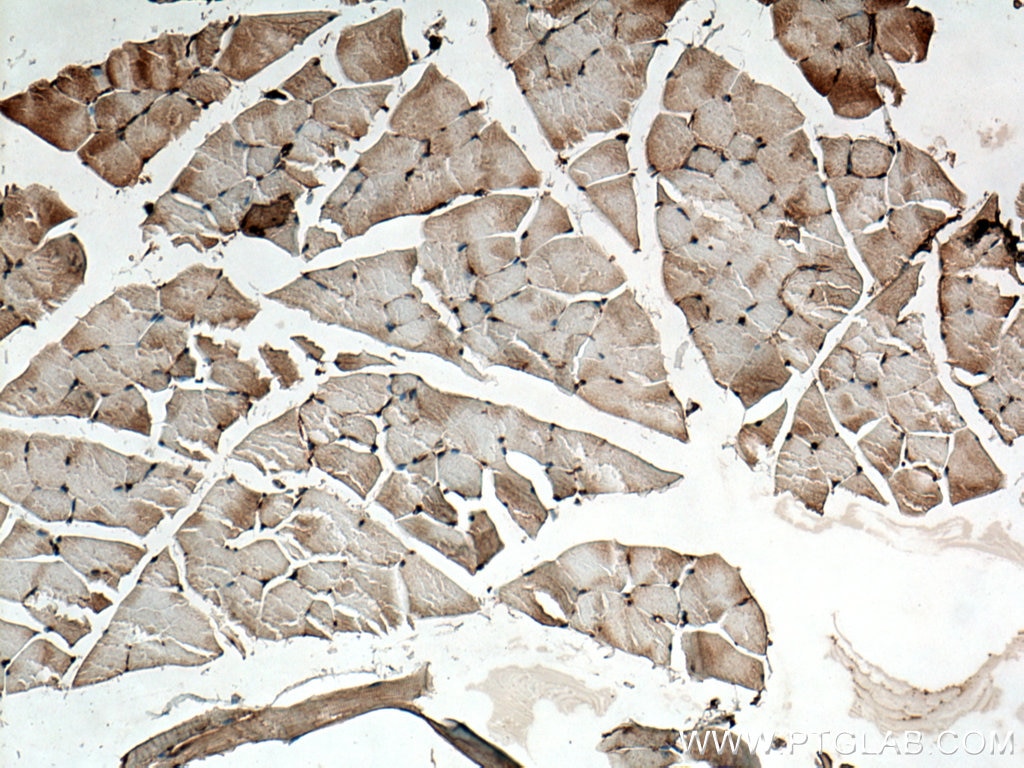 Immunohistochemistry (IHC) staining of mouse skeletal muscle tissue using Thymosin beta 4 Polyclonal antibody (19850-1-AP)