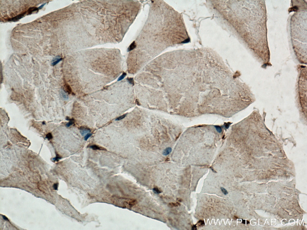 Immunohistochemistry (IHC) staining of mouse skeletal muscle tissue using Thymosin beta 4 Polyclonal antibody (19850-1-AP)