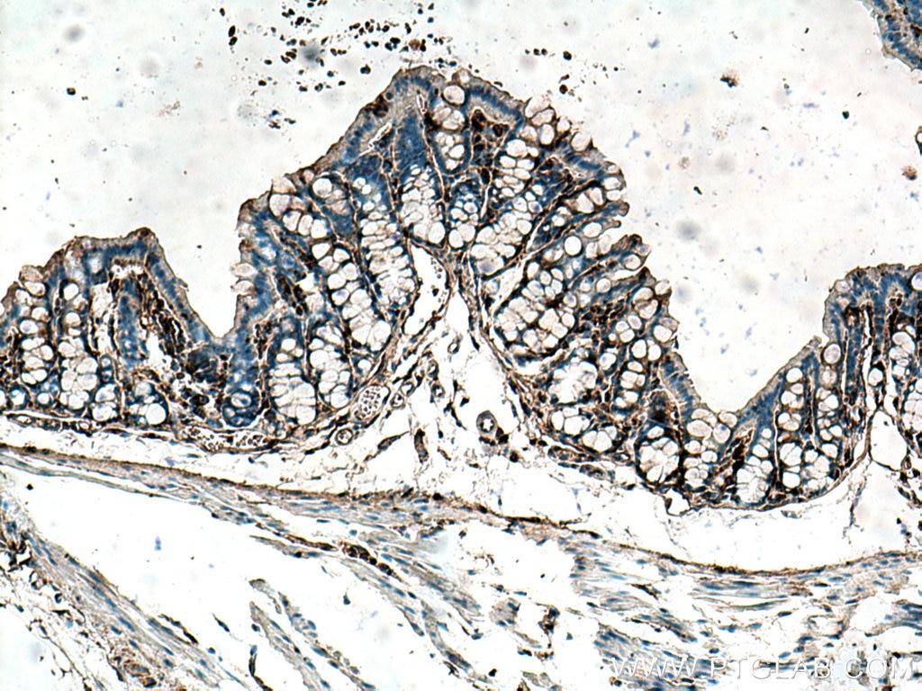 IHC staining of mouse colon using 19850-1-AP