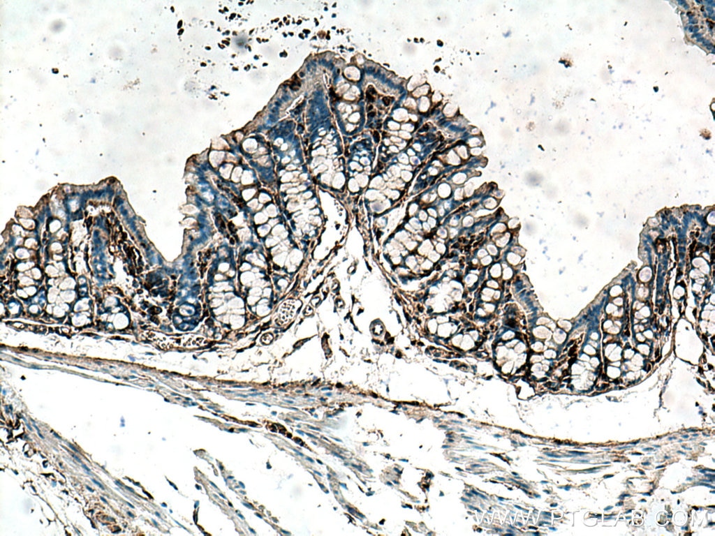 Immunohistochemistry (IHC) staining of mouse colon tissue using Thymosin beta 4 Polyclonal antibody (19850-1-AP)