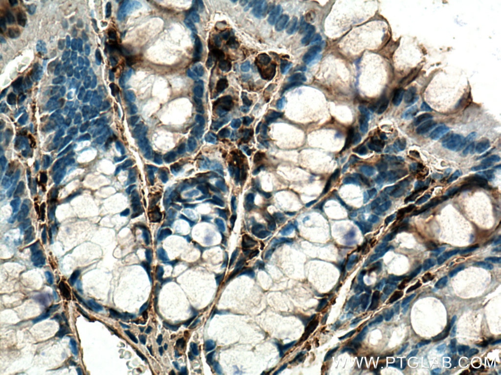 Immunohistochemistry (IHC) staining of mouse colon tissue using Thymosin beta 4 Polyclonal antibody (19850-1-AP)