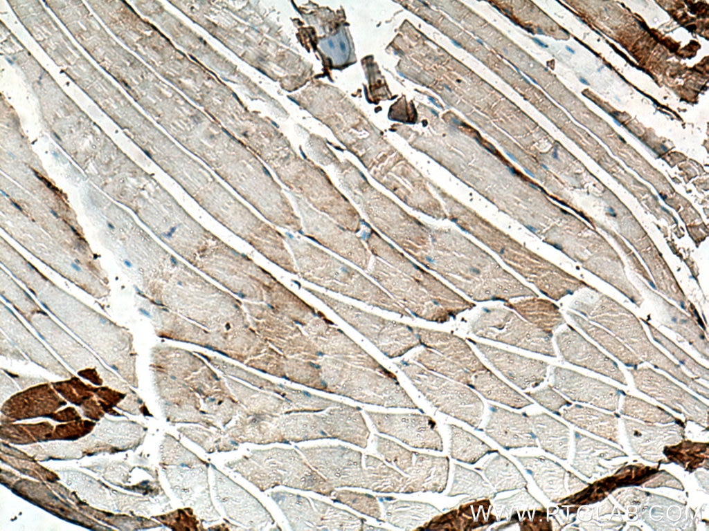 Immunohistochemistry (IHC) staining of mouse skeletal muscle tissue using Thymosin beta 4 Polyclonal antibody (19850-1-AP)