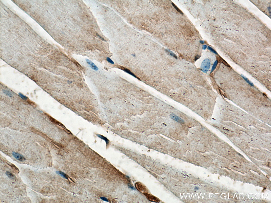 Immunohistochemistry (IHC) staining of mouse skeletal muscle tissue using Thymosin beta 4 Polyclonal antibody (19850-1-AP)