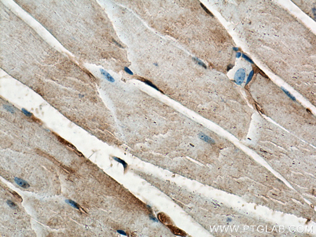 IHC staining of mouse skeletal muscle using 19850-1-AP