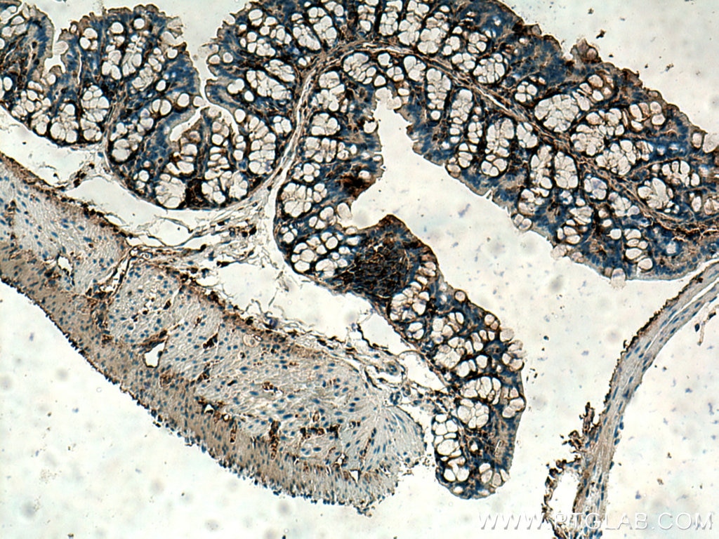 Immunohistochemistry (IHC) staining of mouse colon tissue using Thymosin beta 4 Polyclonal antibody (19850-1-AP)