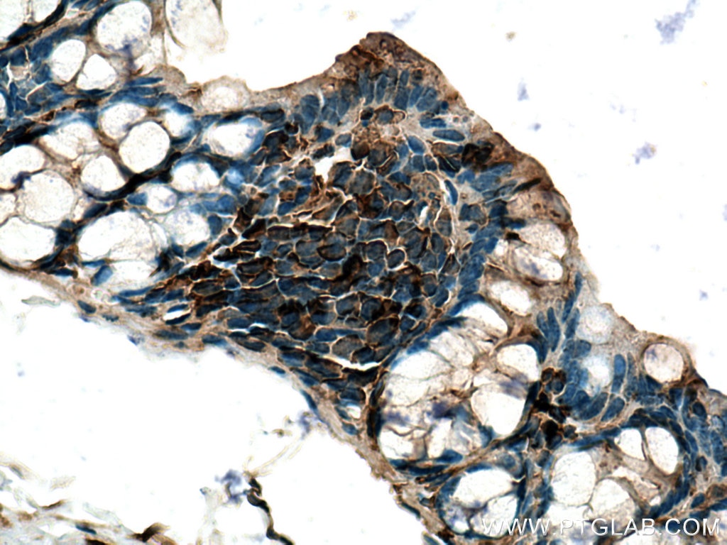 Immunohistochemistry (IHC) staining of mouse colon tissue using Thymosin beta 4 Polyclonal antibody (19850-1-AP)