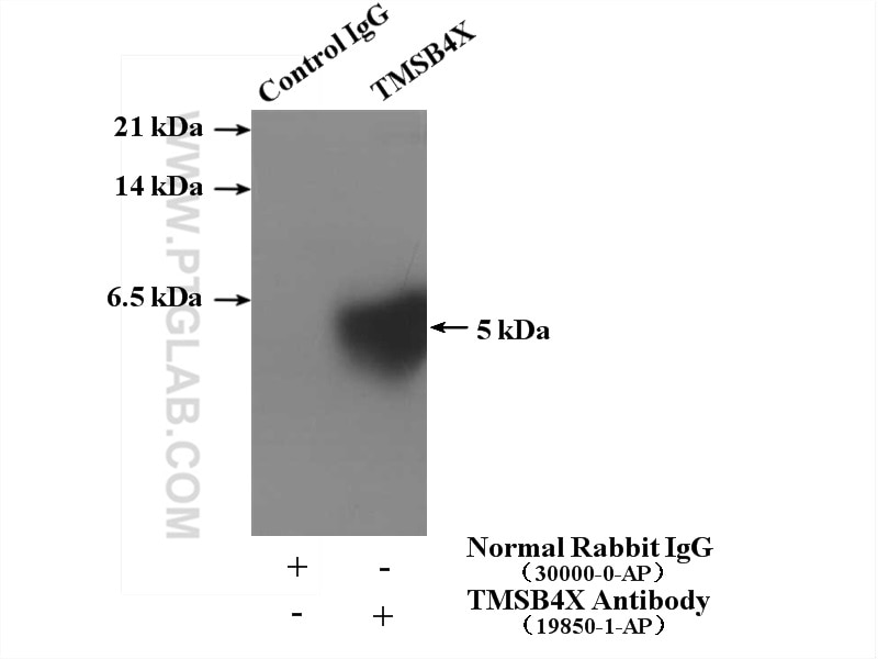 Immunoprecipitation (IP) experiment of mouse skeletal muscle tissue using Thymosin beta 4 Polyclonal antibody (19850-1-AP)