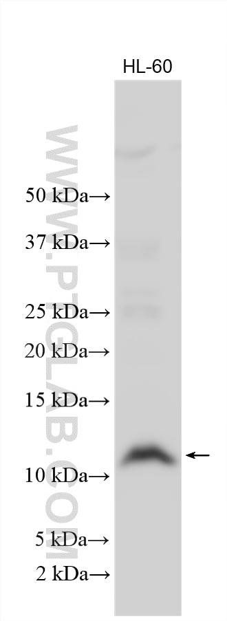 Western Blot (WB) analysis of various lysates using Thymosin beta 4 Polyclonal antibody (19850-1-AP)