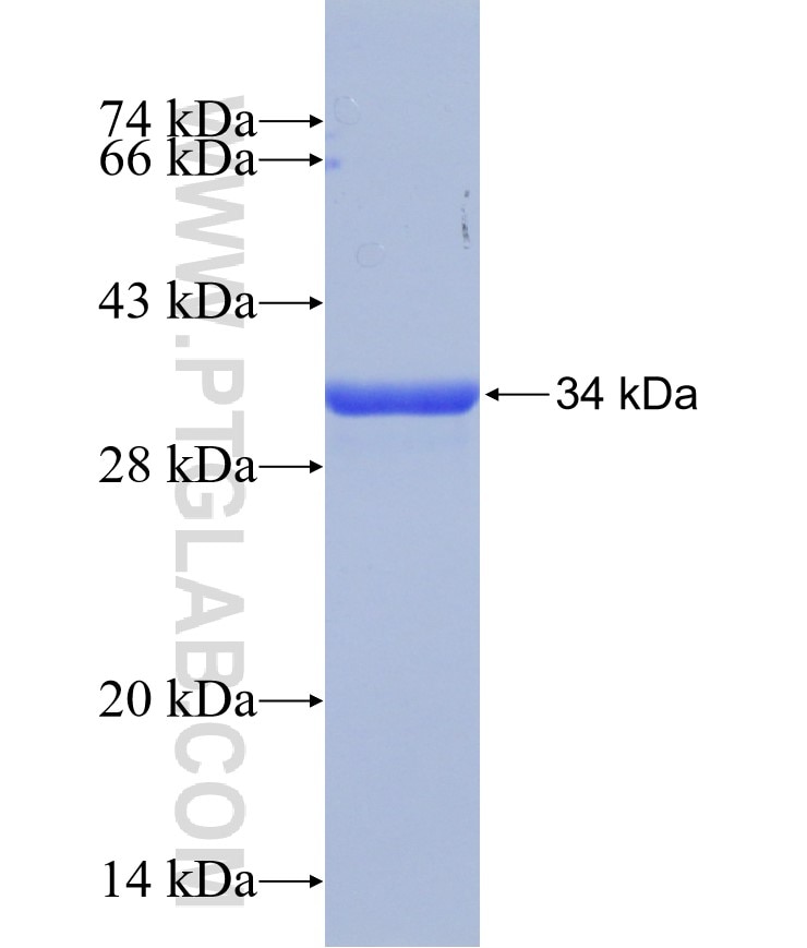 TMSB4X fusion protein Ag31508 SDS-PAGE