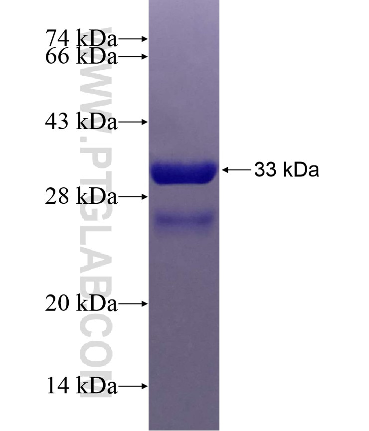 TMSB4X fusion protein Ag13914 SDS-PAGE