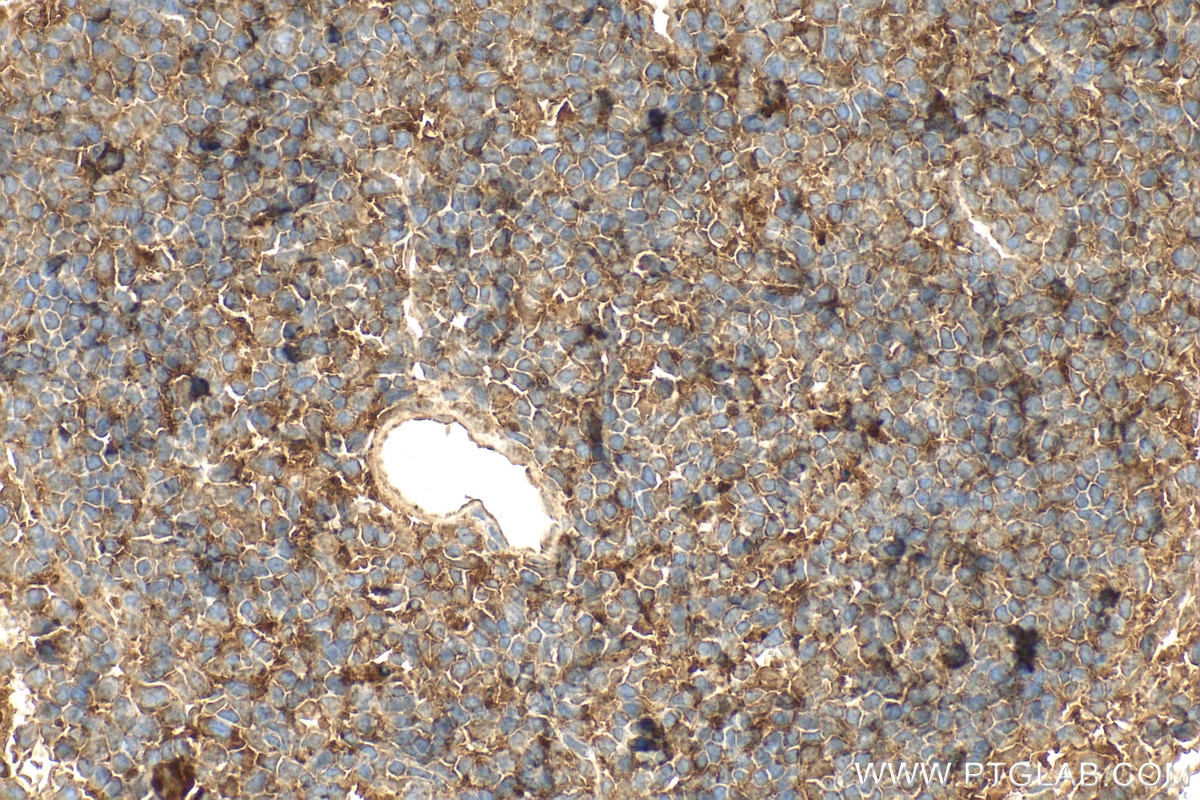 Immunohistochemistry (IHC) staining of mouse spleen tissue using TMTC1 Polyclonal antibody (23349-1-AP)