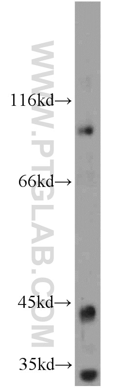 Western Blot (WB) analysis of mouse colon tissue using TMTC1 Polyclonal antibody (23349-1-AP)