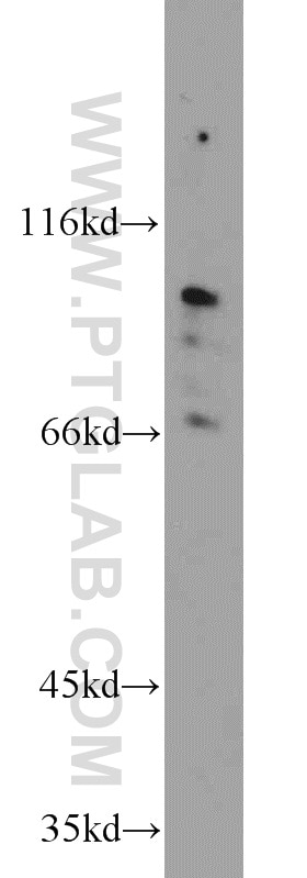 Western Blot (WB) analysis of mouse bladder tissue using TMTC1 Polyclonal antibody (23349-1-AP)