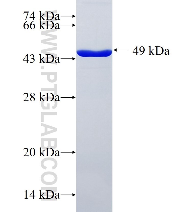 TMTC3 fusion protein Ag36928 SDS-PAGE TMTC3 fusion protein Ag36928 SDS-PAGE