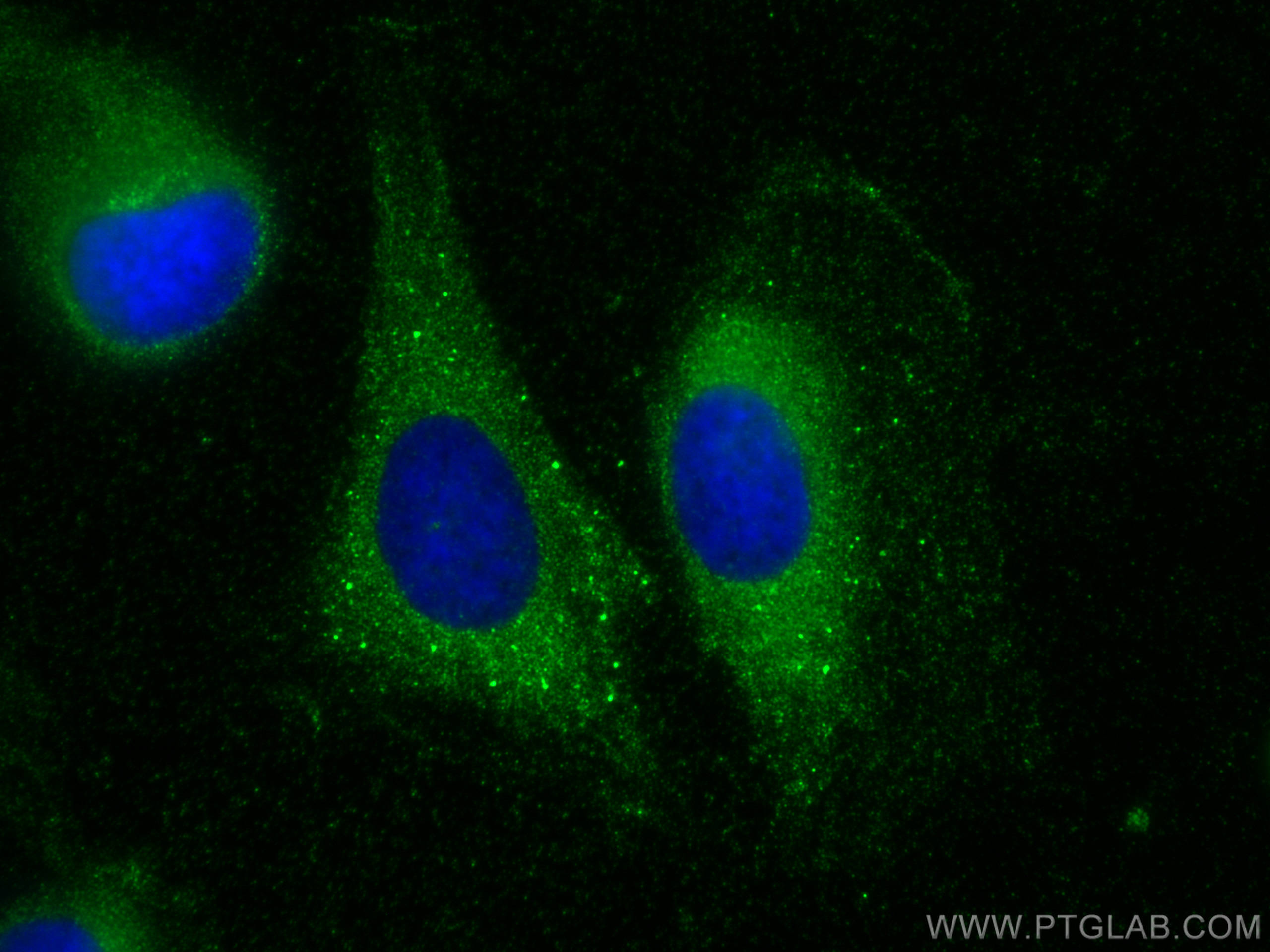 Immunofluorescence (IF) / fluorescent staining of U2OS cells using TMTC4 Polyclonal antibody (25374-1-AP)