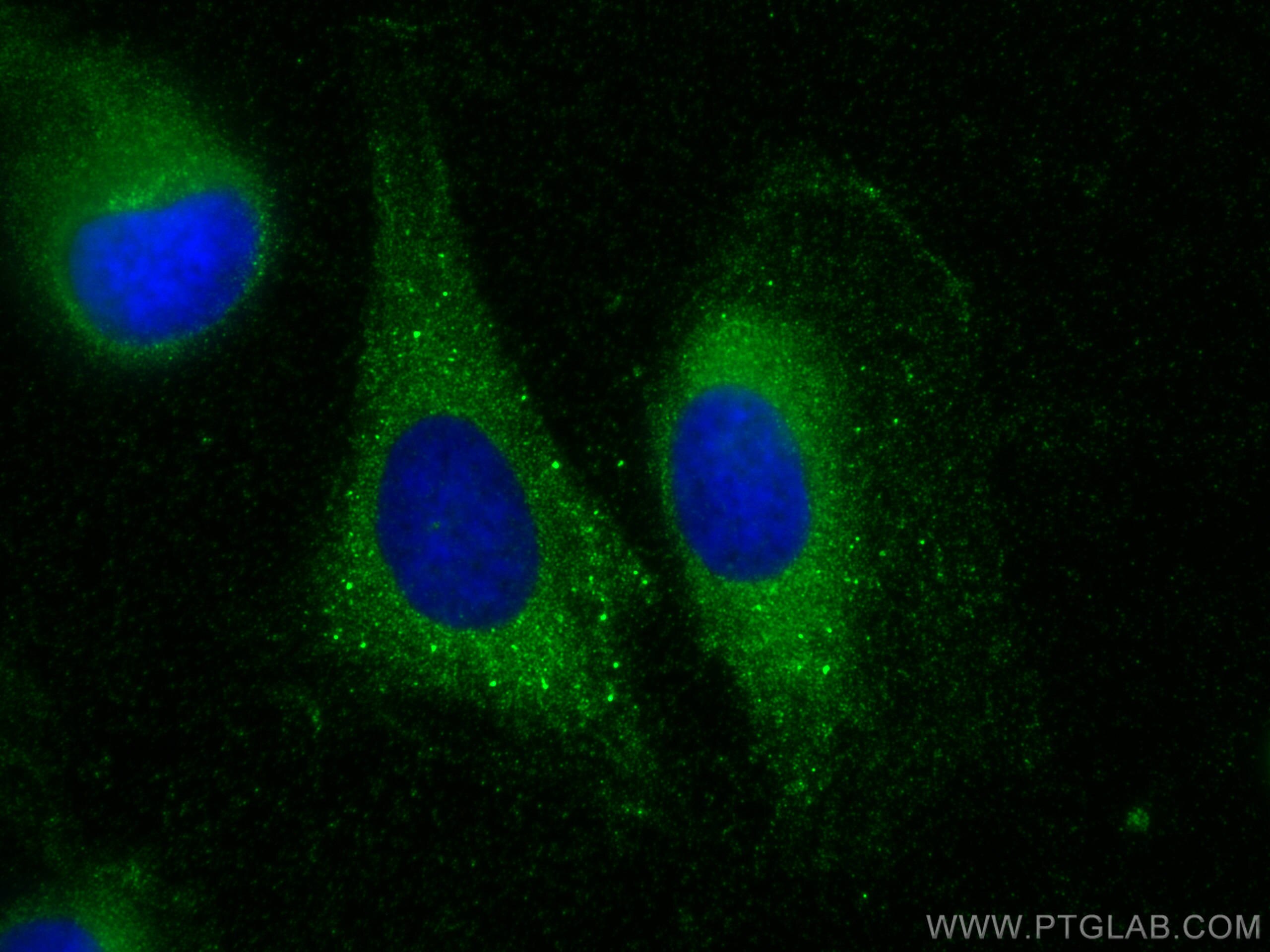 IF Staining of U2OS using 25374-1-AP