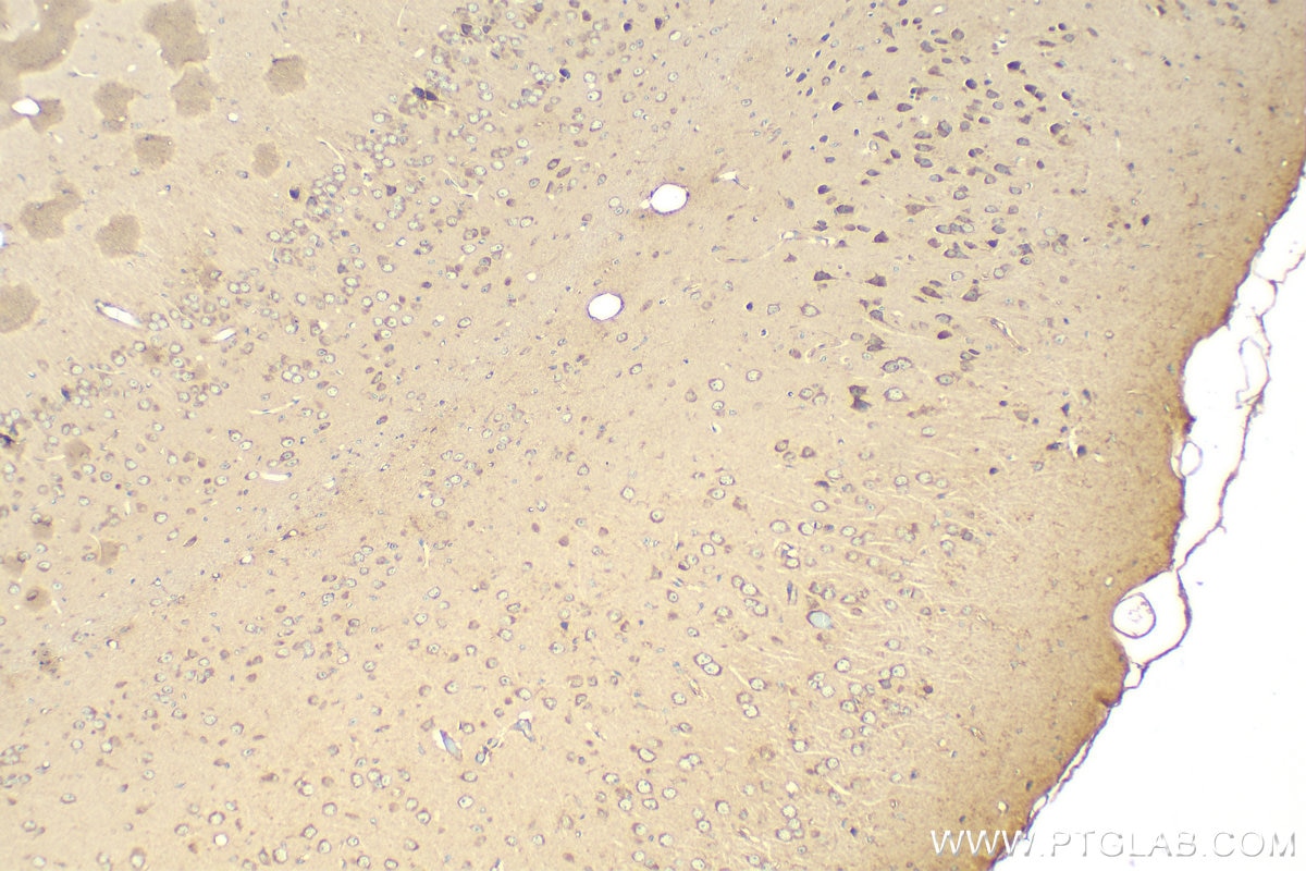 Immunohistochemistry (IHC) staining of mouse brain tissue using TMTC4 Polyclonal antibody (25374-1-AP)