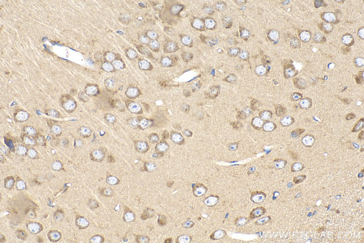Immunohistochemistry (IHC) staining of mouse brain tissue using TMTC4 Polyclonal antibody (25374-1-AP)