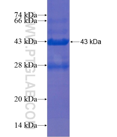 TMTC4 fusion protein Ag21919 SDS-PAGE