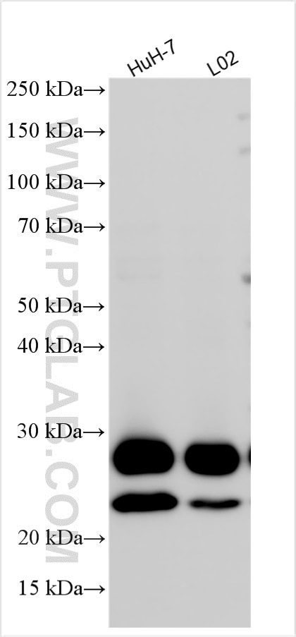 Western Blot (WB) analysis of various lysates using TMUB1 Polyclonal antibody (16638-1-AP)