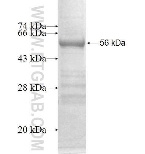TMUB1 fusion protein Ag9988 SDS-PAGE
