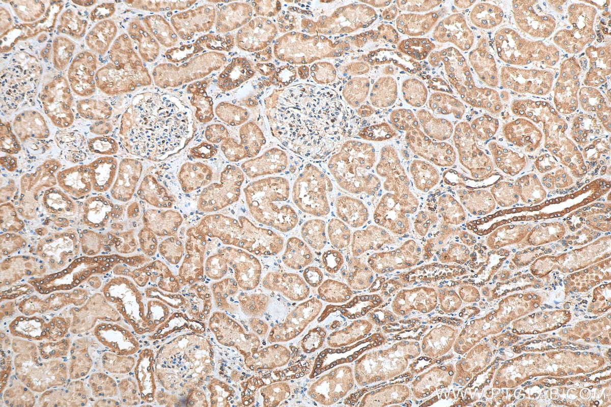 Immunohistochemistry (IHC) staining of human kidney tissue using TMX1 Polyclonal antibody (27489-1-AP)
