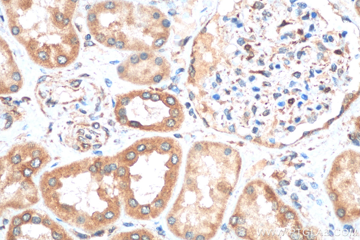 Immunohistochemistry (IHC) staining of human kidney tissue using TMX1 Polyclonal antibody (27489-1-AP)